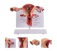 Human Pathological Female Uterus Model Internal Reproductive System Organ Anatomical Model Human Anatomy Model for Medic