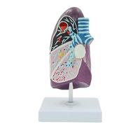 Human Pathological Lung Anatomy Model, Detachable Shows Smoker's Lung, Abscess, TB, Pneumonia and Cancer Human Model