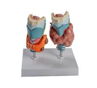Human Pathological Thyroid Anatomy Model with Removable Parts, Anatomical Auditory Organ for Lecture Report Human Pathology Thyroid