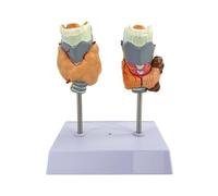 Human Pathology Thyroid Model with Throat, Tumor&Cyst, Realistic Anatomical Thyroid Model, Detachable PVC Teaching Tool for Classroom Demonstration