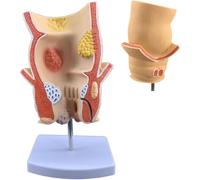 Human Rectal Pathology Model, Simulated Rectal Pathology Model With Anti-slip Base, Accurate Anatomy and Realistic Simulation Design, Exquisite Crafts & Clear Texture, for Clinical Education