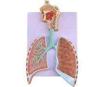 Human Respiratory System Anatomical Model - Detailed Alveoli And Bronchial Tree For Educational Study Of Lungs And Respiratory Tract