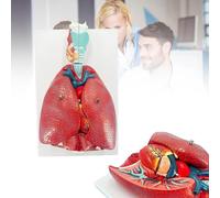 Human Respiratory System Anatomy Model - 7 Detachable Pieces With Lungs, Heart, Larynx, Trachea For Medical Science Education And Teaching