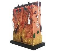 Human Skin Anatomy Model- 3D Skin Tissue Structure Model - for Medical Education Display, Educational Teaching Tool