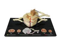Human Spinal Cord Anatomical Model, 5X Spinal Cord Nerve Anatomy Model, Including Vertebral, Nerve Branches,Ganglion& Blood Vessels,for Medical Teaching Study Display