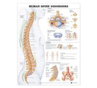 Human Spine Disorders Anatomical Chart