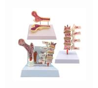 Human Spine Model Osteoporosis Anatomical Model 3pcs Set PVC Material for Science Study Patient Education-Model