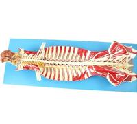 Human Spine Vertebral Canal Anatomical Model Showing Structures Brain and Cerebellar Nerves Spinal Nerves in The Vertebral Canal for Teaching