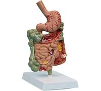 Human Stomach Anatomy Model - Educational Organs Model for Biology Class, Detailed Stomach Section Anatomy for Learning Human Body Structure, Perfect for Students and Teachers