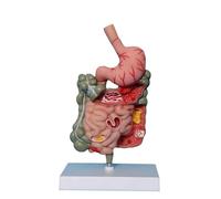 Human Stomach Anatomy Model Pathological Digestive System Model, Removerable Teaching Model, For Classroom Demonstration