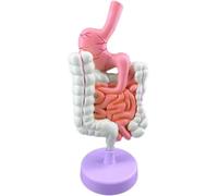 Human Stomach Gastrointestinal Anatomy Model, Pathological Digestive System Model, Large Small Intestinal Disease Model with Detachable Structure, for Medical Teaching Exhibition.