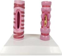 Human Trachea Contrast Model Organ Anatomy Respiratory System Structure Human Healthy Trachea and Pathological Comparison Model Pathology Lung Tube Trachea Comparison Model