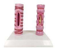 Human Trachea Contrast Model Organ Anatomy Respiratory System Structure Human Healthy Trachea and Pathological Comparison Model - Pathology Lung Tube Trachea Comparison Model