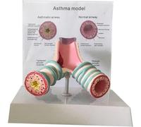 Human Tracheal Case Model - Anatomical Bronchial for Asthma and Respiratory Study