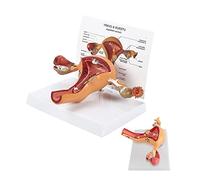 Human Uterus Lesion Model Ovarian Model Natural Large Pathological Uterus Model, Model The Anatomical Structure Of Female Internal Reproductive Organ