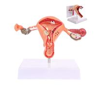 Human Uterus Model, Uterus Model Anatomy, Female Internal Reproduction Anatomy Model, Life Size Uterus And Ovary Model Reproductive Organ Model For Studying And Communication