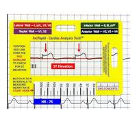 Huxibai Badge Reference Cards,Measuring Guide Quick Reference | Portable Measuring Supplies for Medicine Cardiology Rotations Clinical