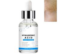 Hyaluronic Acid Serum for Face with Vitamin C, Smooths Wrinkles and Fine Lines, Anti-Aging, Wrinkle Reduction Brightening Serum, Hydrating Moisturizing for All Skin Types, Plumping Firming (1Pcs)