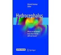 Hydrocephalus: What do we know? And what do we still not know?