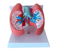 HYYKEJI Lung Pathologies Anatomical Model, Human Organ Anatomy Model, 1: 1 Life Size, Respiratory Lung Healthy Lung and Pathology Comparison Demonstration Teaching Aid