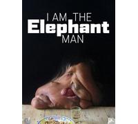 I Am The Elephant Man