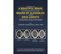 I Have a Beautiful Brain, Compared to the Brains of Alcoholics and Drug Addicts : A Sincere Attempt to Reduce the Attractiveness of Alcohol for Children, Teenagers, and Young Adults