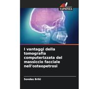 I vantaggi della tomografia computerizzata del massiccio facciale nell'osteopetrosi
