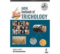 IADVL Textbook of Trichology