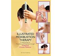 Illustrated Moxibustion Therapy: A Natural Way of Prevention and Treatment through Traditional Chinese Medicine