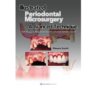 Illustrated Periodontal Microsurgery: Advanced Technique Soft Tissue Management for the Ultimate Esthetic Result