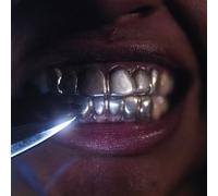 Upchuck I'm Nice Now (Vinyl) 12" Album Coloured Vinyl