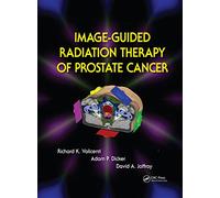 Image-Guided Radiation Therapy of Prostate Cancer