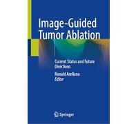 Image-Guided Tumor Ablation: Current Status and Future Directions