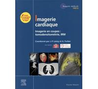 Imagerie cardiaque: Imagerie en coupes : scanner, IRM