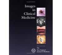 Images in Clinical Medicine: Selections from The New England Journal of Medicine