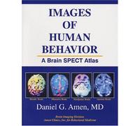 Images of Human Behavior: A Brain SPECT Atlas