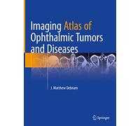 Imaging Atlas of Ophthalmic Tumors and Diseases
