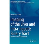 Imaging of the Liver and Intra-hepatic Biliary Tract: Volume 2: Tumoral Pathologies (Medical Radiology)