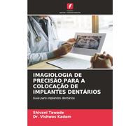 IMAGIOLOGIA DE PRECISÃO PARA A COLOCAÇÃO DE IMPLANTES DENTÁRIOS: Guia para implantes dentários
