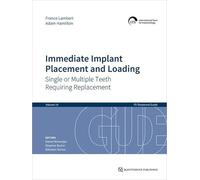 Immediate Implant Placement and Loading: Single or Multiple Teeth Requiring Replacement: 14 (ITI Treatment Guides, 14)