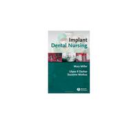 Implant Dental Nursing: Essential Guide for Dental Nurses in Implant Dentistry