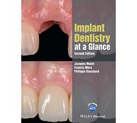 Implant Dentistry at a Glance, 2nd Edition (At a Glance (Dentistry))