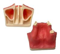 Implant Model Maxillary Sinus Lifting Exercise Soft Gums Maxillary Sinus Lift Practice Model - Dental Implant Practice Model - Oral Simulation Implant Soft Gum Dental Material