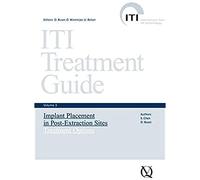 Implant Placement in Post-extraction Sites: Treatment Options (3) (ITI Treatment Guide)