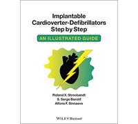 Implantable Cardioverter - Defibrillators Step by Step: An Illustrated Guide