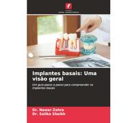 Implantes basais: Uma visão geral: Um guia passo a passo para compreender os implantes basais
