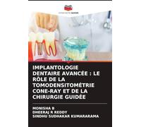Implantologie Dentaire Avancée: Le Rôle de la Tomodensitométrie Cone-Ray Et de la Chirurgie Guidée