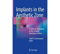 Implants in the Aesthetic Zone: A Guide for Treatment of the Partially Edentulous Patient