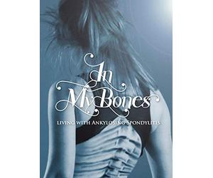 In My Bones: Living With Ankylosing Spondylitis