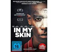 In My Skin – Damson Idris, Kate Beckinsale, Gugu Mbatha-Raw, John Dagleish – DVD – Region 2
